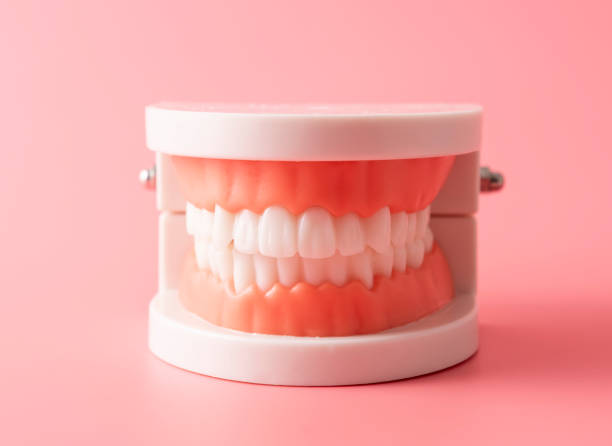 O que é uma prótese dentária? Um guia completo para você sorrir de novo!